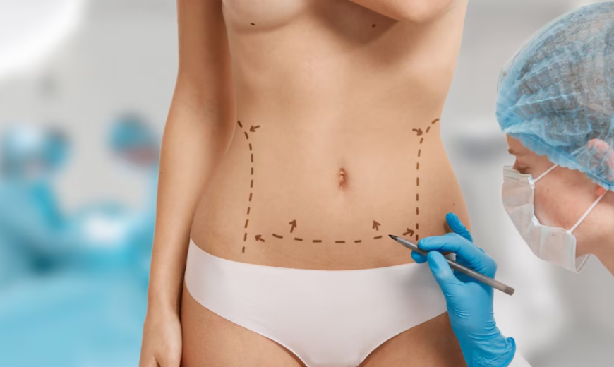 Plastik, Rekonstrüktif ve Estetik Cerrahi